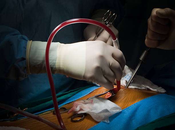 درمان پریکاردیت با جراحی