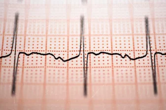 تفاوت حمله قلبی با نارسایی قلبی